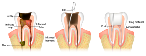 Teeth Chart